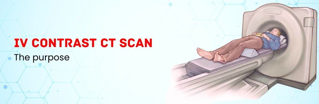 What is the Purpose of I V Contrast CT Scan?